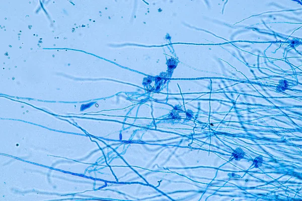 Penicillium Hongos Ascomicetos Son Gran Importancia Entorno Natural Así Como —  Fotos de Stock