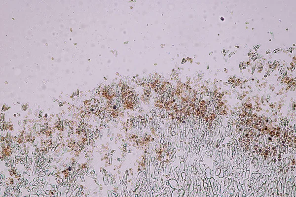 Penicillium Hongos Ascomicetos Son Gran Importancia Entorno Natural Así Como —  Fotos de Stock