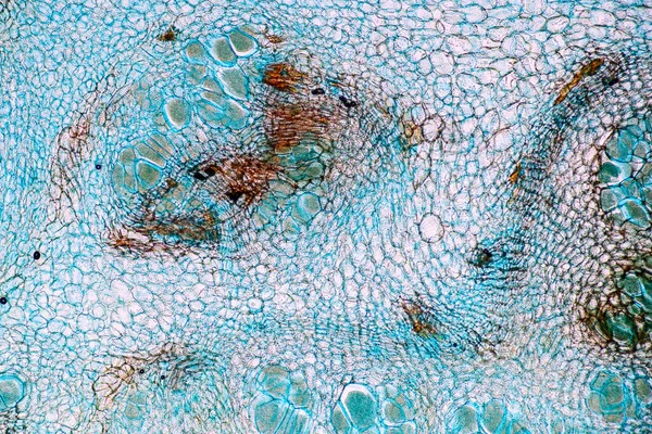 Sporlu Sahibi Hücreler Küf Eğitim Için Mikroskop Altında Odunların Içindedir — Stok fotoğraf