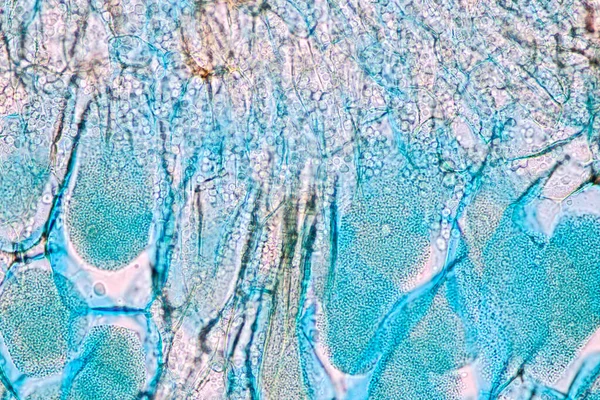 Komórki Gospodarza Zarodnikami Pleśń Wewnątrz Drewna Pod Mikroskopem Edukacji — Zdjęcie stockowe