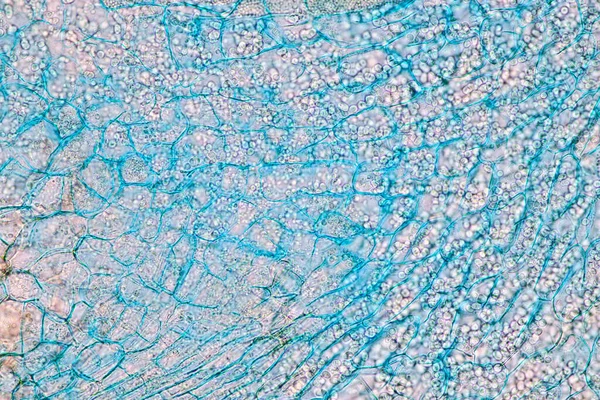 Celulele Gazdă Spori Mucegai Sunt Interiorul Lemnului Sub Microscop Pentru — Fotografie, imagine de stoc