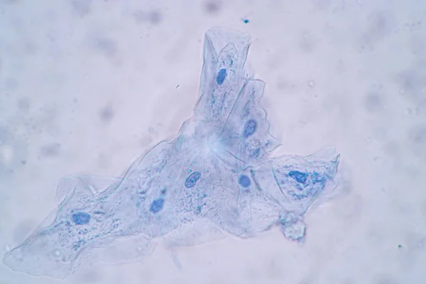 显微镜下人体鳞状上皮细胞 细胞结构 特征的实验研究 — 图库照片