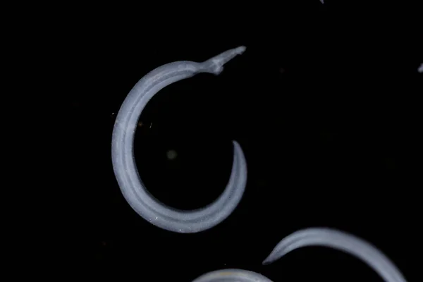 住血吸虫 Schistosoma はトレマトーデス属の一種で 研究室での教育のために顕微鏡下で一般的に血煙として知られている — ストック写真