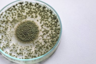 Aspergillus oryzae 'nin yakınında, laboratuvarda eğitim için soya fasulyesi fermantasyonu gibi besin üretiminde kullanılan lifli bir mantar veya küf bulunur..