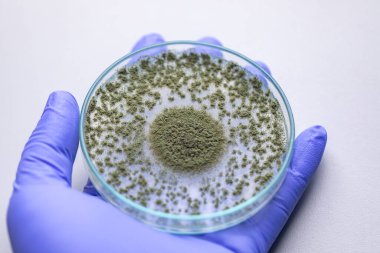 Aspergillus oryzae 'nin yakınında, laboratuvarda eğitim için soya fasulyesi fermantasyonu gibi besin üretiminde kullanılan lifli bir mantar veya küf bulunur..