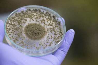 Aspergillus oryzae 'nin yakınında, laboratuvarda eğitim için soya fasulyesi fermantasyonu gibi besin üretiminde kullanılan lifli bir mantar veya küf bulunur..