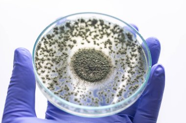Aspergillus oryzae 'nin yakınında, laboratuvarda eğitim için soya fasulyesi fermantasyonu gibi besin üretiminde kullanılan lifli bir mantar veya küf bulunur..