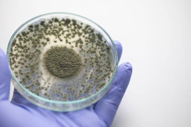 Aspergillus oryzae 'nin yakınında, laboratuvarda eğitim için soya fasulyesi fermantasyonu gibi besin üretiminde kullanılan lifli bir mantar veya küf bulunur..