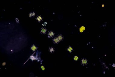 Protozoa ve Yeşil Algler mikroskop altında atık suda.