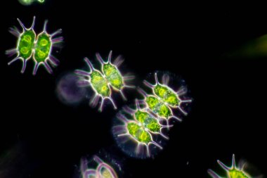 Protozoa ve Yeşil Algler mikroskop altında atık suda.