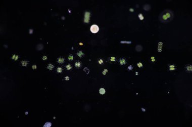 Protozoa ve Yeşil Algler mikroskop altında atık suda.