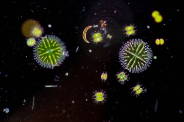 Protozoa ve Yeşil Algler mikroskop altında atık suda.