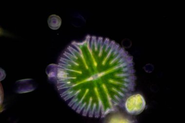 Protozoa ve Yeşil Algler mikroskop altında atık suda.