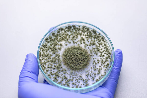Close up of Aspergillus oryzae is a filamentous fungus, or mold that is used in food production, such as in soybean fermentation for education in laboratory.