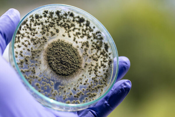 Close up of Aspergillus oryzae is a filamentous fungus, or mold that is used in food production, such as in soybean fermentation for education in laboratory.