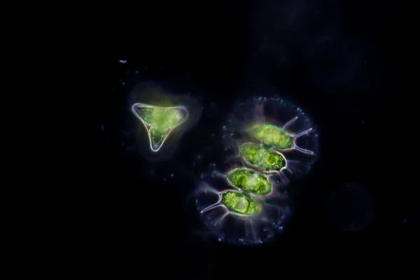 Protozoa and Green Algae in waste water under the microscope.