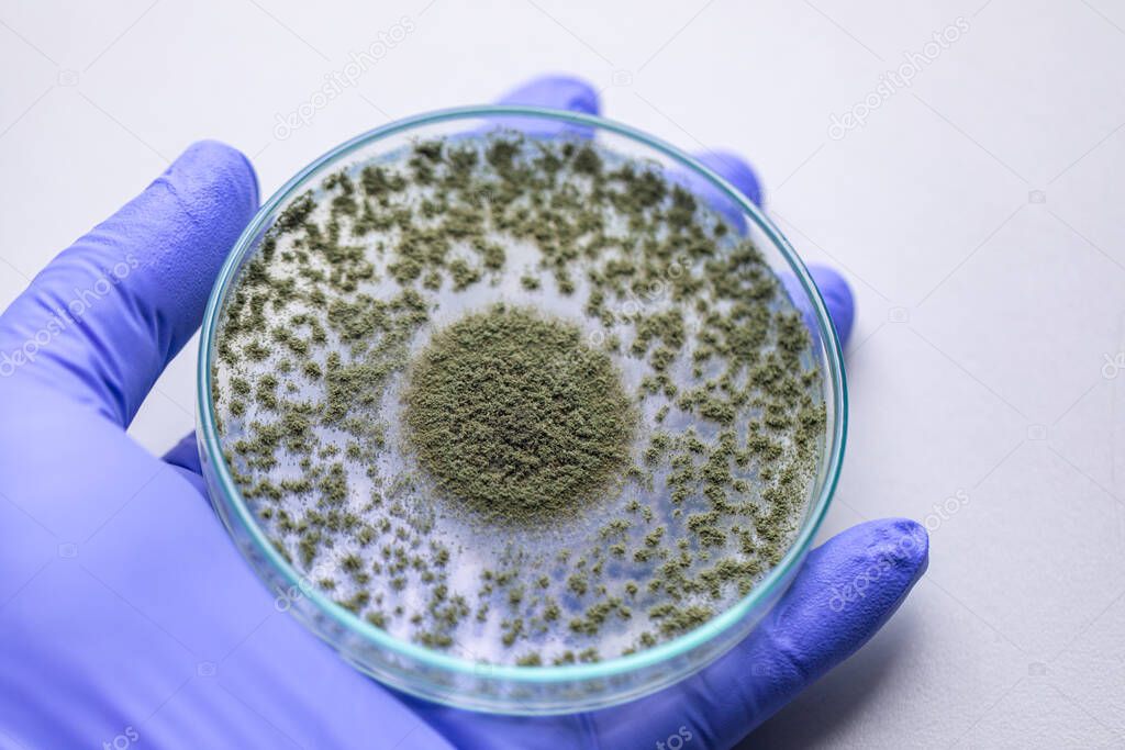 Close up of Aspergillus oryzae is a filamentous fungus, or mold that is used in food production, such as in soybean fermentation for education in laboratory.