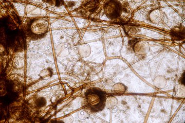 Rhizopus 'un özellikleri, eğitim için mikroskop altında kayan yaygın bir safirik mantar cinsidir..