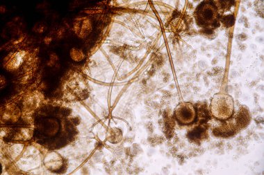 Rhizopus 'un özellikleri, eğitim için mikroskop altında kayan yaygın bir safirik mantar cinsidir..