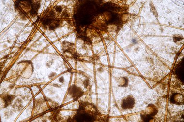 Rhizopus 'un özellikleri, eğitim için mikroskop altında kayan yaygın bir safirik mantar cinsidir..