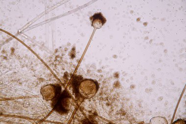 Rhizopus 'un özellikleri, eğitim için mikroskop altında kayan yaygın bir safirik mantar cinsidir..