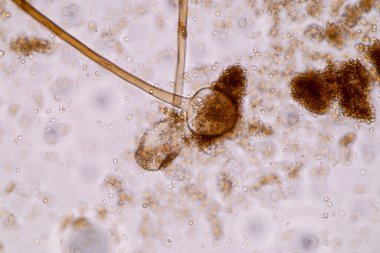 Rhizopus 'un özellikleri, eğitim için mikroskop altında kayan yaygın bir safirik mantar cinsidir..