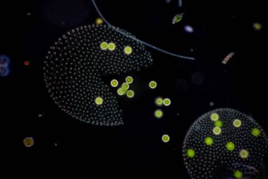 Volvox, sınıf eğitimi için mikroskop altında su damlasında.