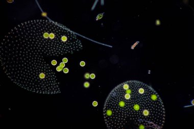 Volvox, sınıf eğitimi için mikroskop altında su damlasında.