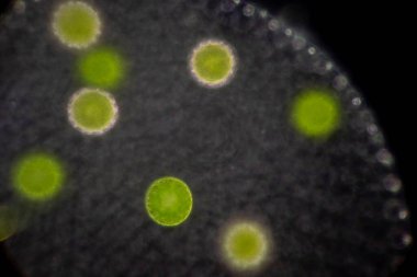 Volvox, sınıf eğitimi için mikroskop altında su damlasında.