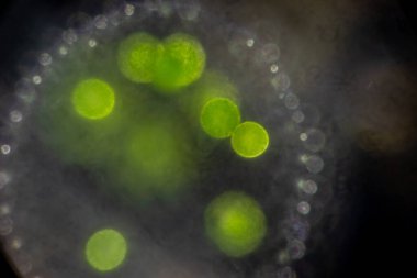 Volvox, sınıf eğitimi için mikroskop altında su damlasında.