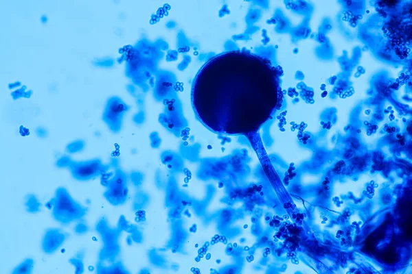 Rhizopus 'un özellikleri, eğitim için mikroskop altında kayan yaygın bir safirik mantar cinsidir..