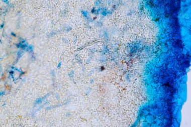 Ormanda grup olarak yaşayan mantarların özellikleri, eğitim için mikroskop altında polifiletiktir..