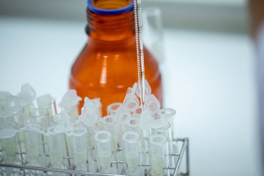 Laboratuvarda Coronavirus aşısı COVID-19 'un geliştirilmesi ve üretilmesi. Laboratuvarda Covid-19 aşısı.)