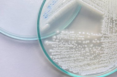 Pichia, Saccharomycetaceae familyasından bir maya cinsidir..