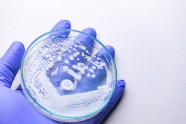 Pichia, Saccharomycetaceae familyasından bir maya cinsidir..