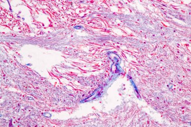 Laboratuvarda mikroskop altında Eğitim Omuriliği, Sinir, Beyincik, Korteks ve Motor Nöron İnsanı.