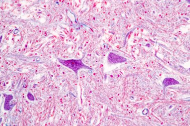 Laboratuvarda mikroskop altında Eğitim Omuriliği, Sinir, Beyincik, Korteks ve Motor Nöron İnsanı.