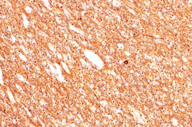 Laboratuvarda mikroskop altında Eğitim Omuriliği, Sinir, Beyincik, Korteks ve Motor Nöron İnsanı.