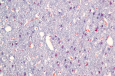 Laboratuvarda mikroskop altında Eğitim Omuriliği, Sinir, Beyincik, Korteks ve Motor Nöron İnsanı.