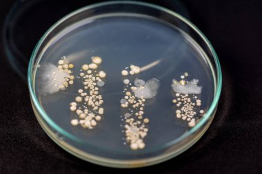 Mold Beautiful, Colony of Characteristics of Fungus (Mold) in culture medium plate from laboratory microbiology.