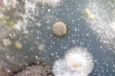 Mold Beautiful, Colony of Characteristics of Fungus (Mold) in culture medium plate from laboratory microbiology. clipart