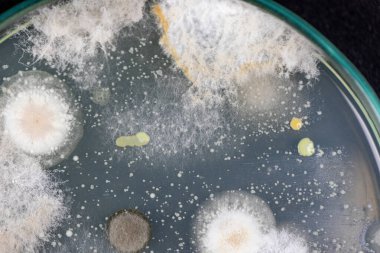 Mold Beautiful, Colony of Characteristics of Fungus (Mold) in culture medium plate from laboratory microbiology.