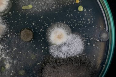 Mold Beautiful, Colony of Characteristics of Fungus (Mold) in culture medium plate from laboratory microbiology.