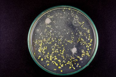 Mold Beautiful, Colony of Characteristics of Fungus (Mold) in culture medium plate from laboratory microbiology.