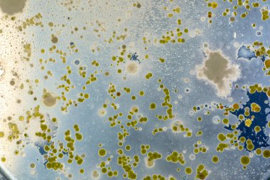 Mold Beautiful, Colony of Characteristics of Fungus (Mold) in culture medium plate from laboratory microbiology.