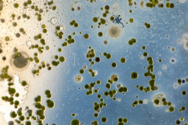 Mold Beautiful, Colony of Characteristics of Fungus (Mold) in culture medium plate from laboratory microbiology.