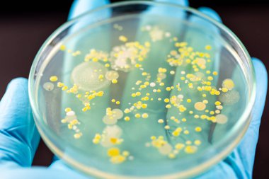 Mold Beautiful, Colony of Characteristics of Fungus (Mold) in culture medium plate from laboratory microbiology.