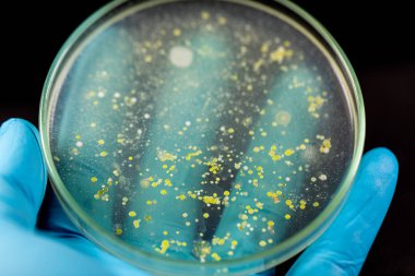 Mold Beautiful, Colony of Characteristics of Fungus (Mold) in culture medium plate from laboratory microbiology.