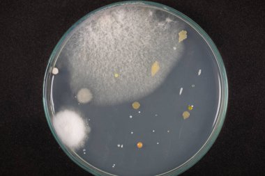Mold Beautiful, Colony of Characteristics of Fungus (Mold) in culture medium plate from laboratory microbiology.