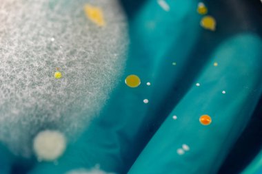 Mold Beautiful, Colony of Characteristics of Fungus (Mold) in culture medium plate from laboratory microbiology.